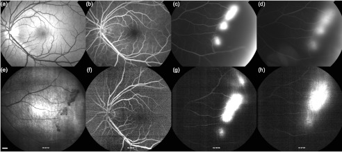 Fig. 11