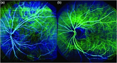 Fig. 12