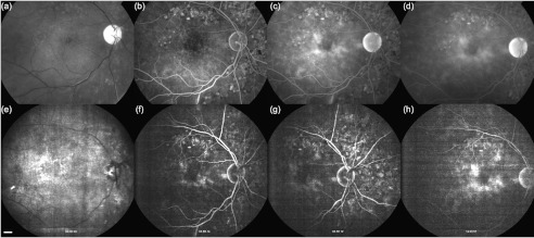 Fig. 9