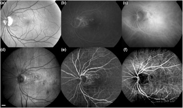 Fig. 7