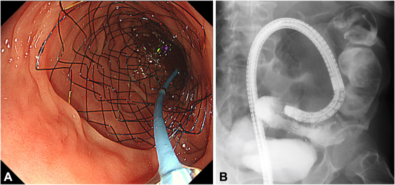 Figure 4