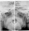 Fig. (1)