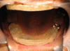 Fig. (2)