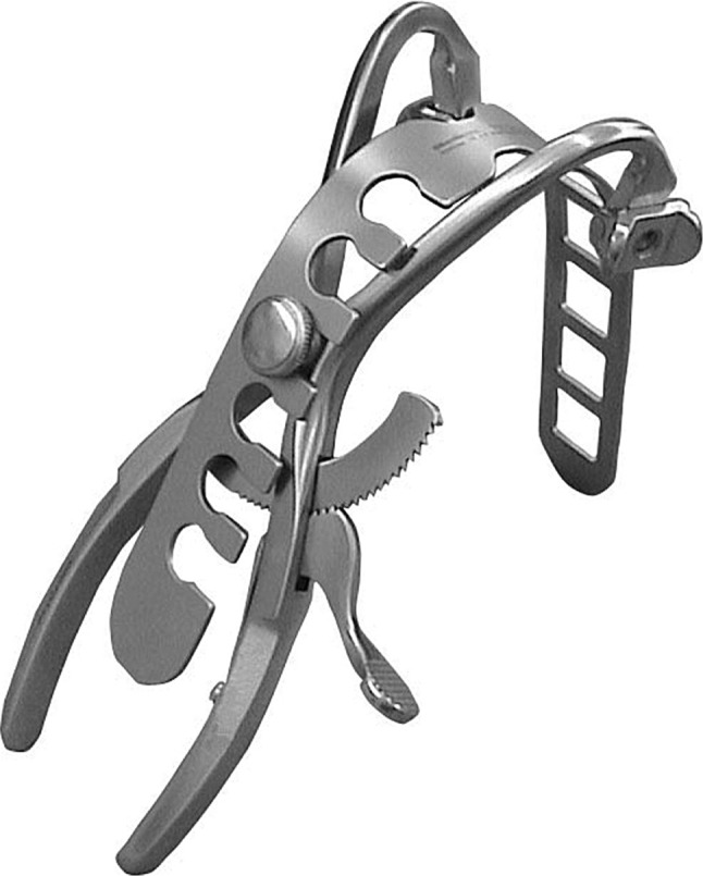 Fig. 1