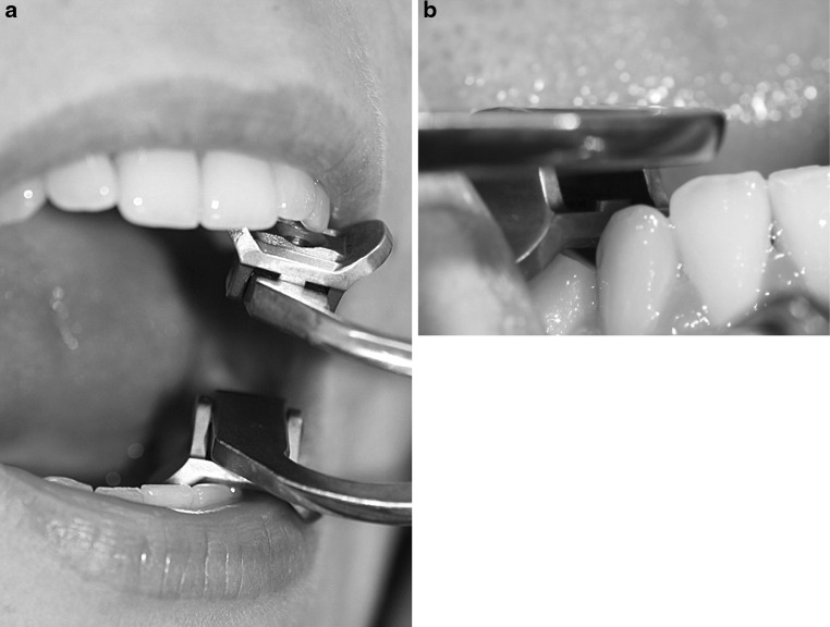 Fig. 3