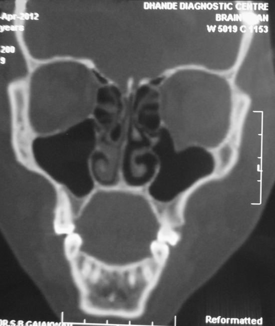 Fig. 2