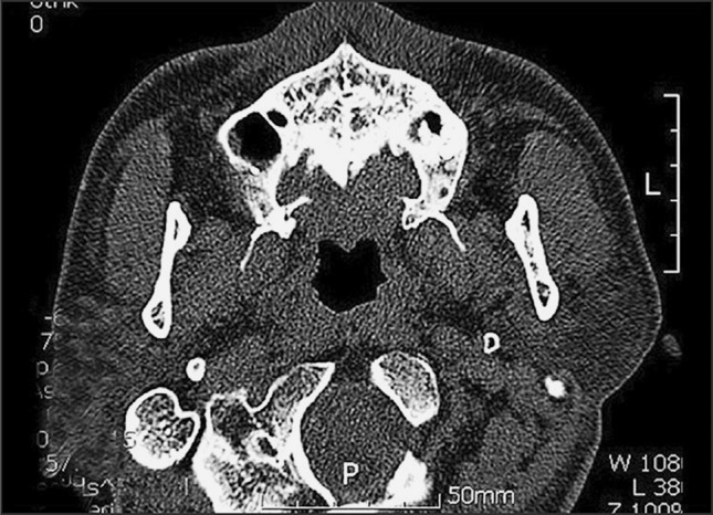 Fig. 12