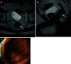 Fig. 23