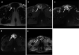 Fig. 18