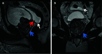Fig. 21