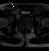 Fig. 20
