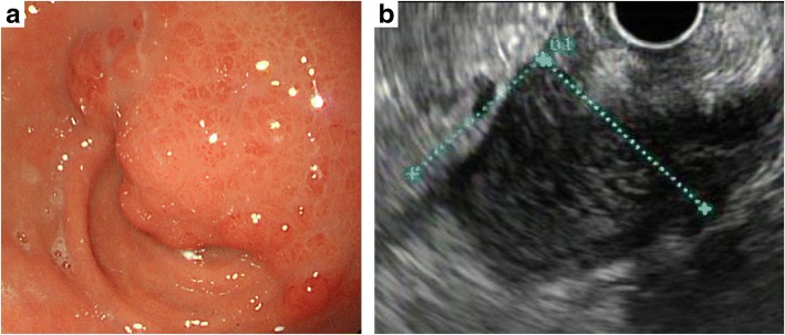 Fig. 2