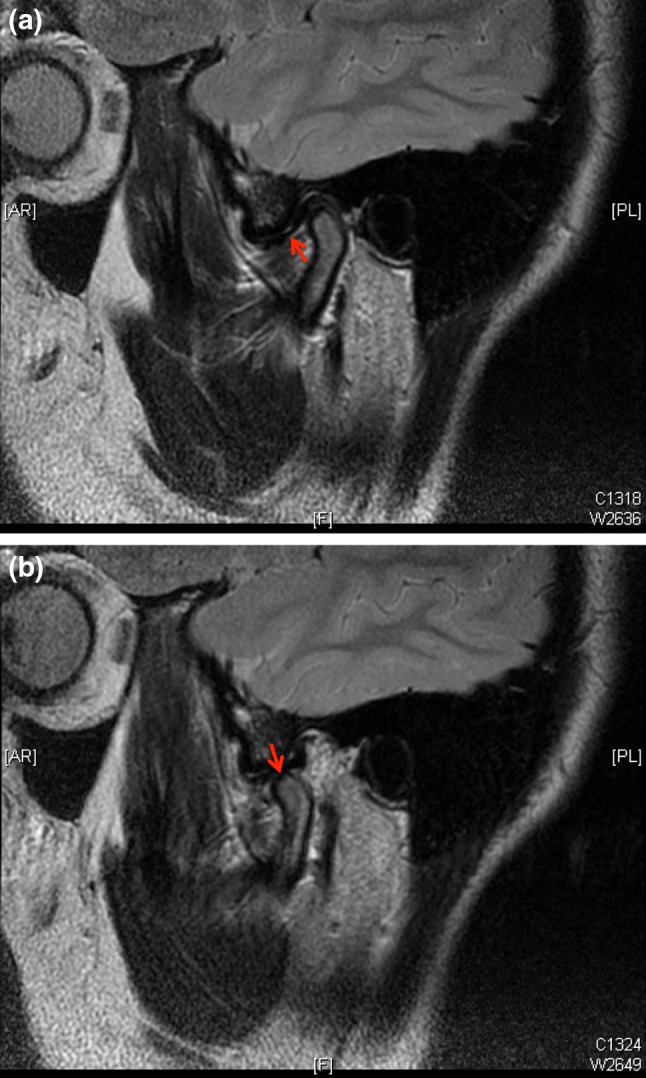 Fig. 4