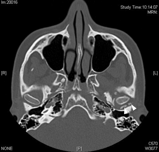 Fig. 1