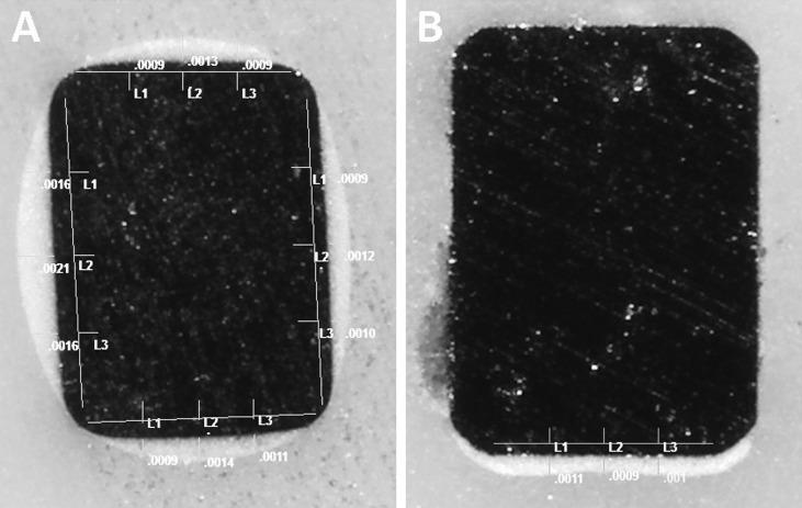 Figure 1. Stereoscope images of coating thickness measurement method: (A) group IV with all surfaces coated and (B) group II with coating only on the labial surface. Original magnification 45×.