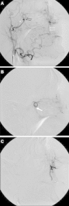 Fig. 2