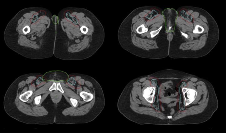 Figure 1