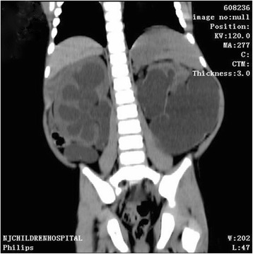 Fig. 2