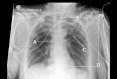 Fig 12