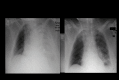 Fig 10