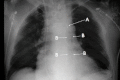 Fig 13