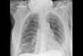 Fig 11