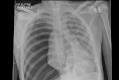 Fig 7