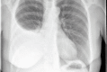 Fig 9