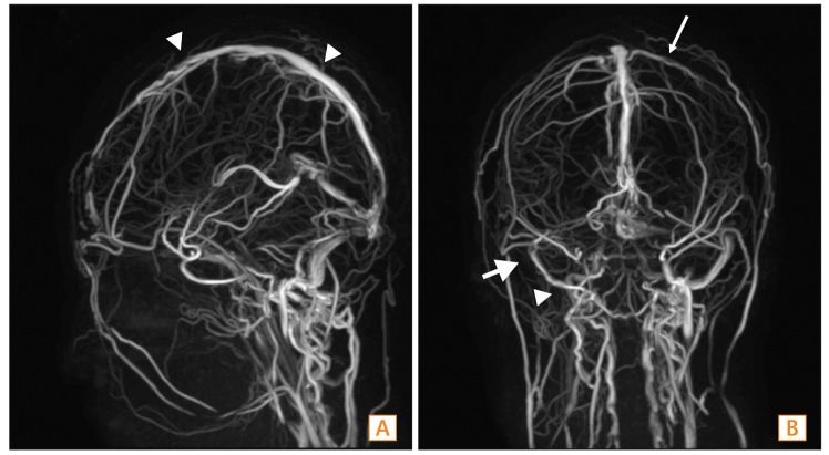 Fig. 5