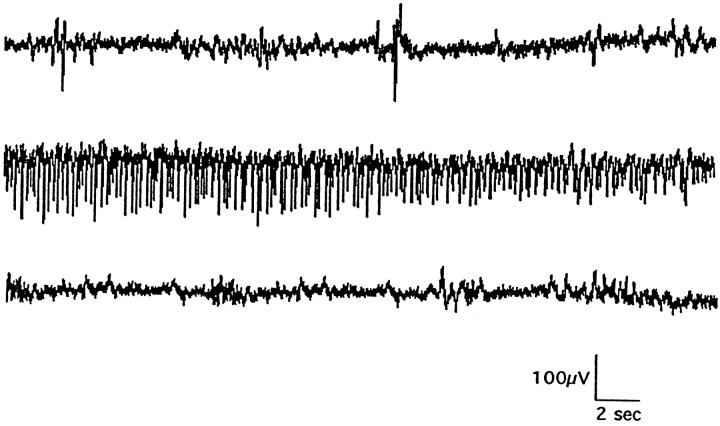 Fig. 11.