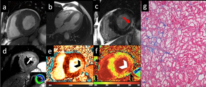 Fig. 4