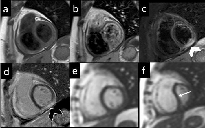 Fig. 7