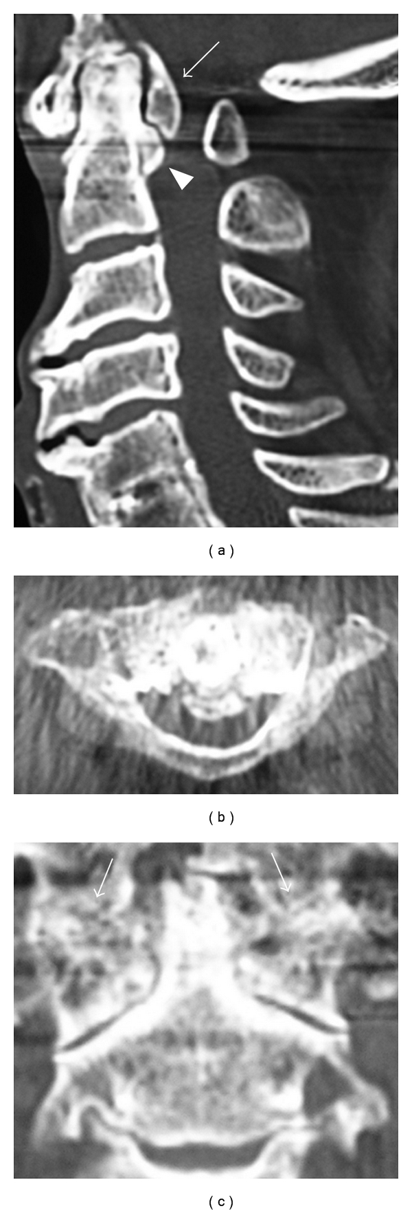 Figure 2