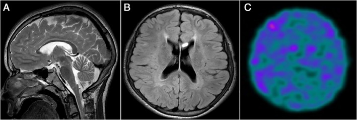 FIG. 1