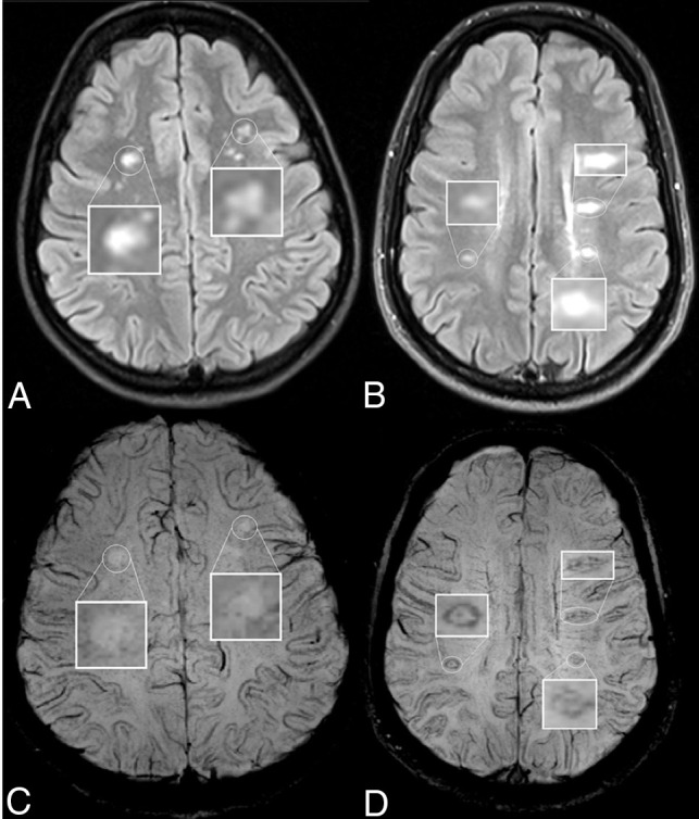 Fig 2.