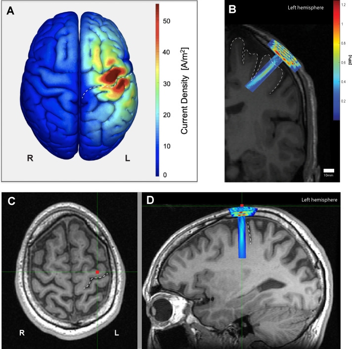 Figure 2.