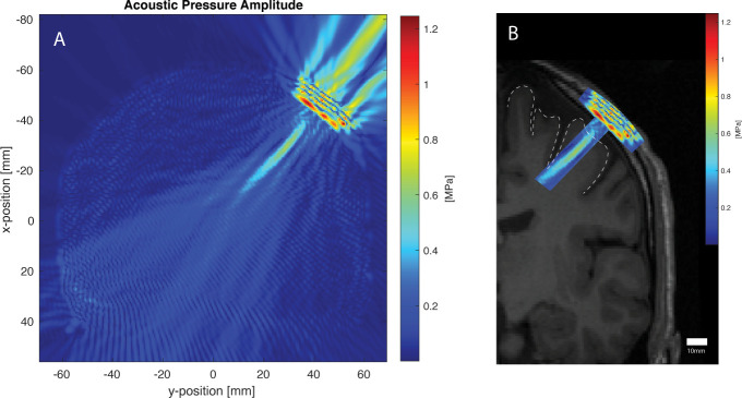 Appendix 1—figure 3.