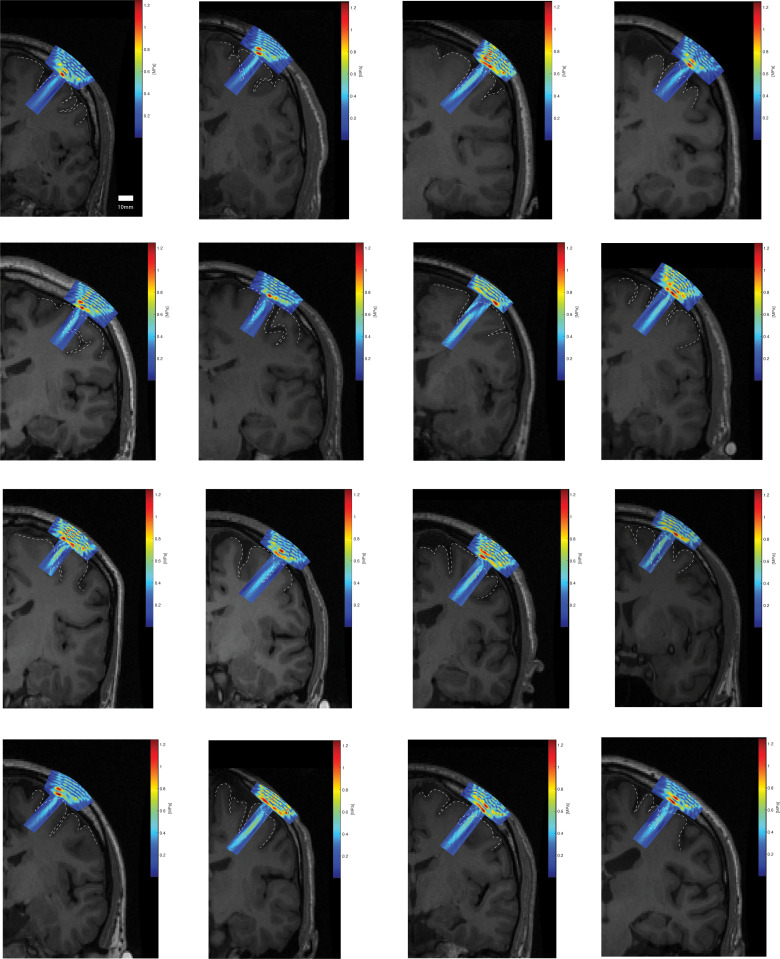 Figure 2—figure supplement 1.