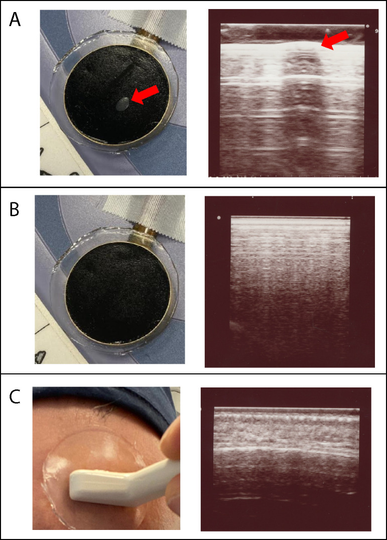 Appendix 2—figure 1.