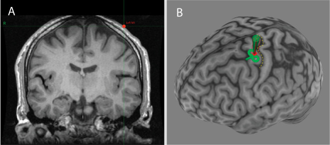 Appendix 1—figure 1.