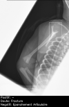 Fig 7