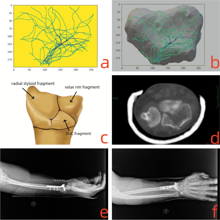 Fig. 6