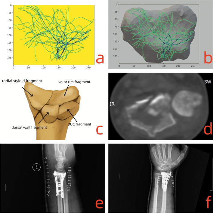 Fig. 10