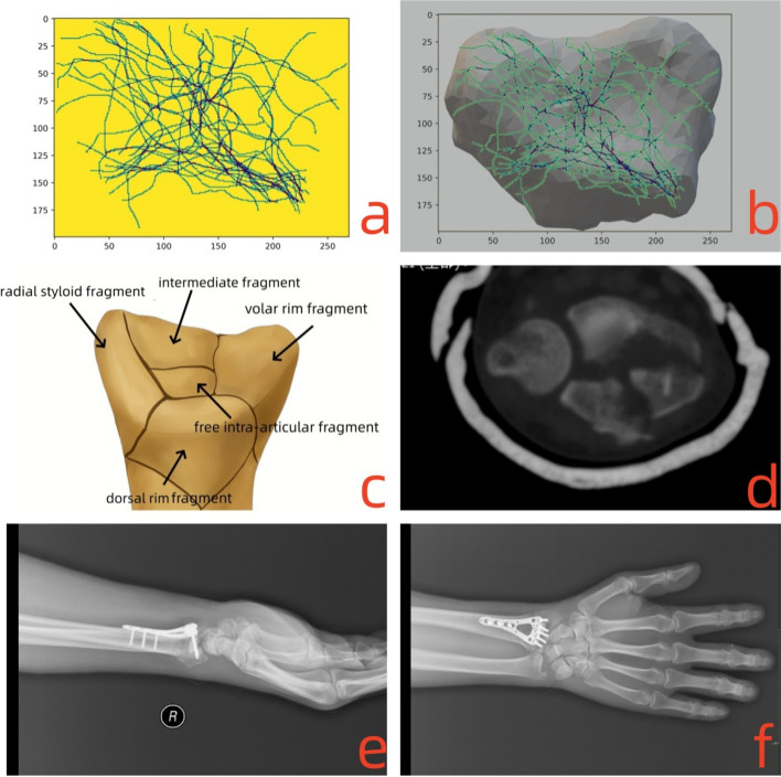 Fig. 9