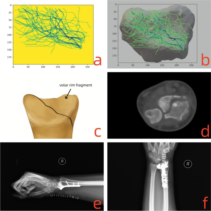 Fig. 4