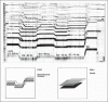 Top: spectrogram [59 – 2000 Hz/15’27” – 17’08”/bars 215 – 227] of Haas’ String Quartet nº2. Bottom: corresponding drawings