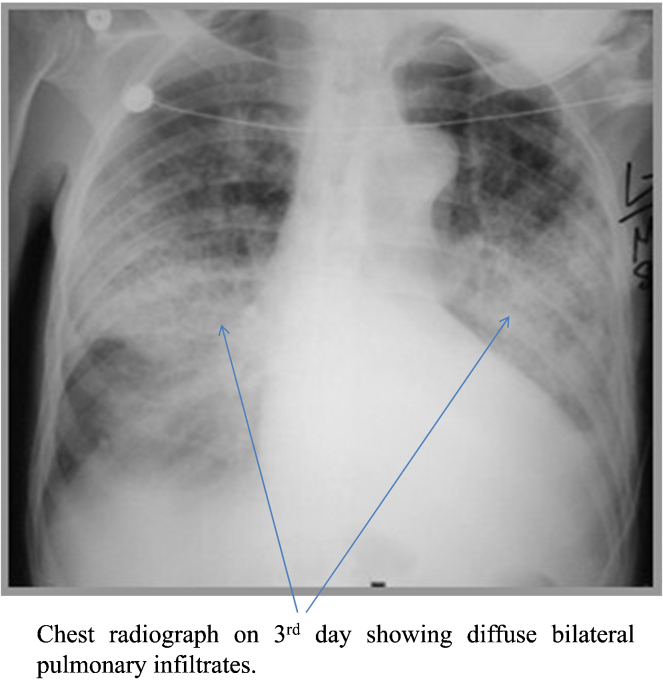 Fig. 1.6