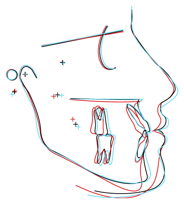 Figure 11