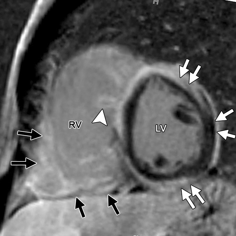 Figure 14b