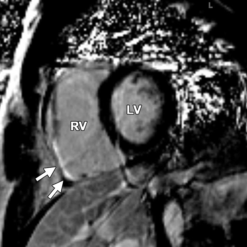 Figure 15a